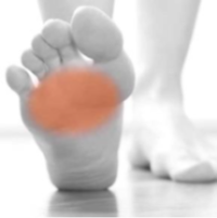 Metatarsalgia